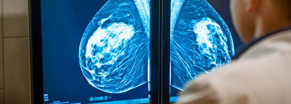 Metabolismo local de los estrógenos mediante CYP1B1 en mama, útero y ovario